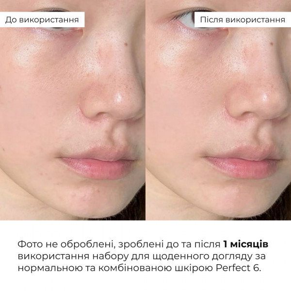Набір для щоденного догляду за нормальною та комбінованою шкірою Hillary Perfect 6