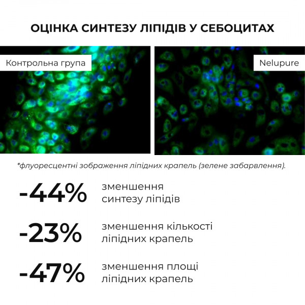 Весенний уход для жирного типа кожи