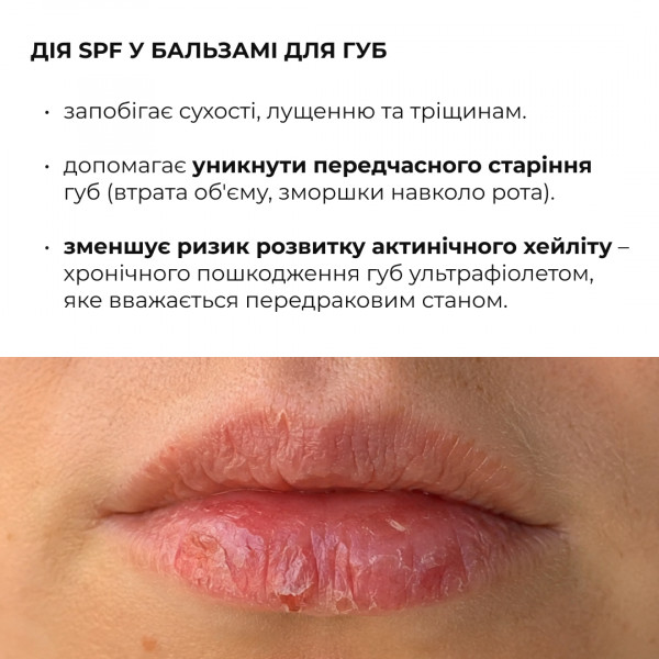 Комплекс для ежедневной SPF защиты губ и лица Hillary Daily Lip Face SPF Protection Complex
