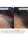 Мезороллер для кожи головы + Комплекс для роста волос Hop Cones B5 Hair Growth Invigorating