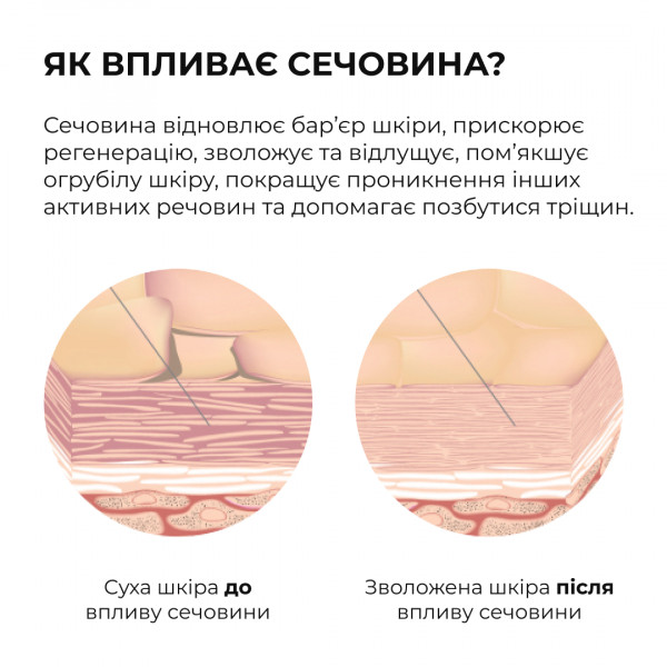 Мягкая отшелушивающая пенка с кислотами для тела Hillary Soft Exfoliation AHA Body Foam, 150 мл