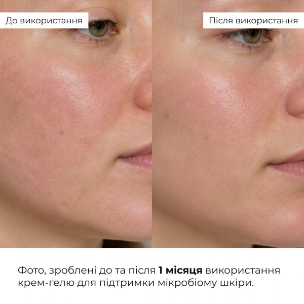 Набір для заспокоєння шкіри та підтримки захисного бар’єра Hillary Soothing & Skin Barrier Support Set