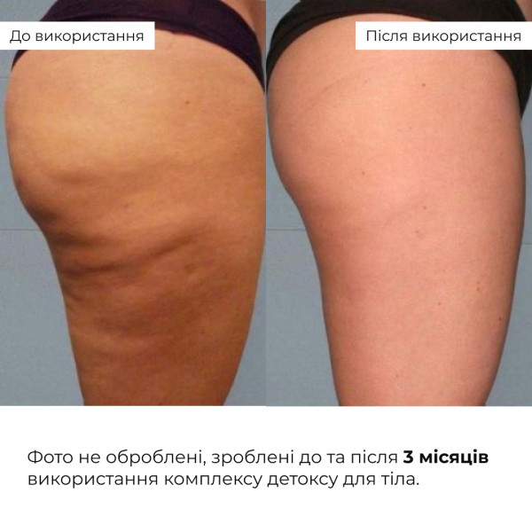 Комплекс детокса для тела Hillary Body Detox Complex