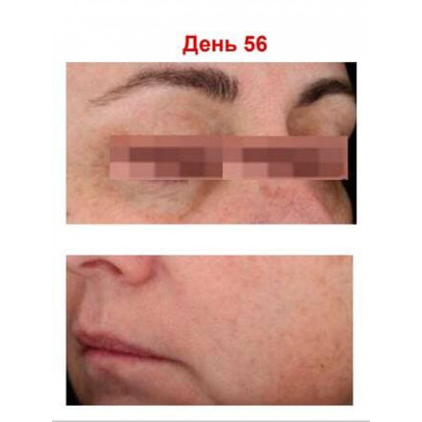 Антиоксидантная пептидная сыворотка с витамином C Hillary Antioxidant Age Reverse Serum 30+, 30 мл