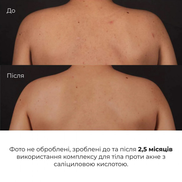 Набор косметических средств для ухода за кожей тела Hillary Body Care