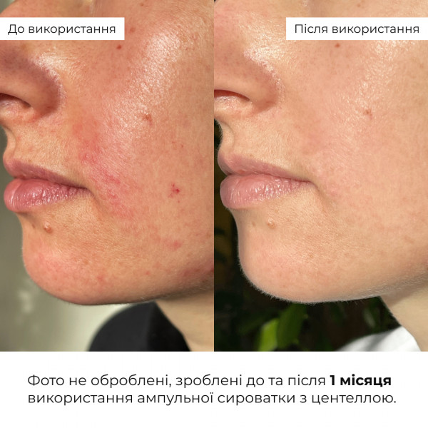 Комплекс щоденного догляду для нормальної та сухої шкіри Hillary Daily Care Complex for Normal & Dry Skin