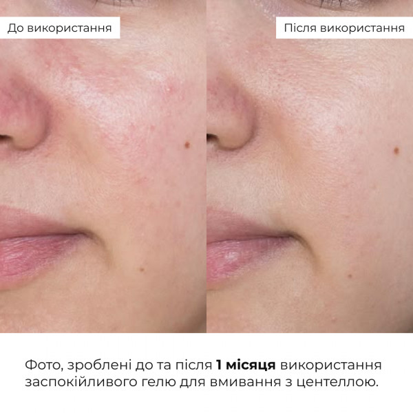 Комплекс щоденного догляду для нормальної та сухої шкіри Hillary Daily Care Complex for Normal & Dry Skin
