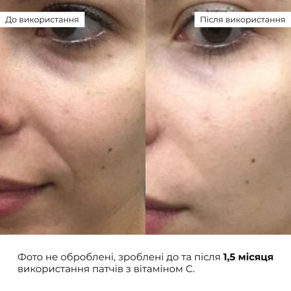 Освежающие укрепляющие патчи с витамином C Hillary Vitamin C Refreshing Firming Eye Patches, 60 шт
