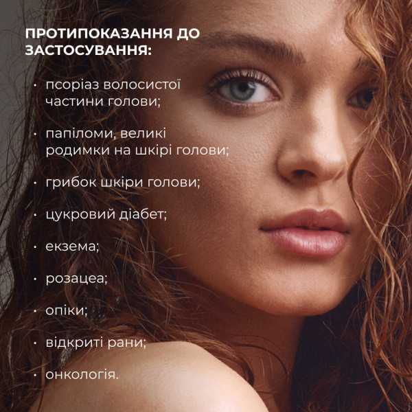 Мезороллер для шкіри голови Hillary