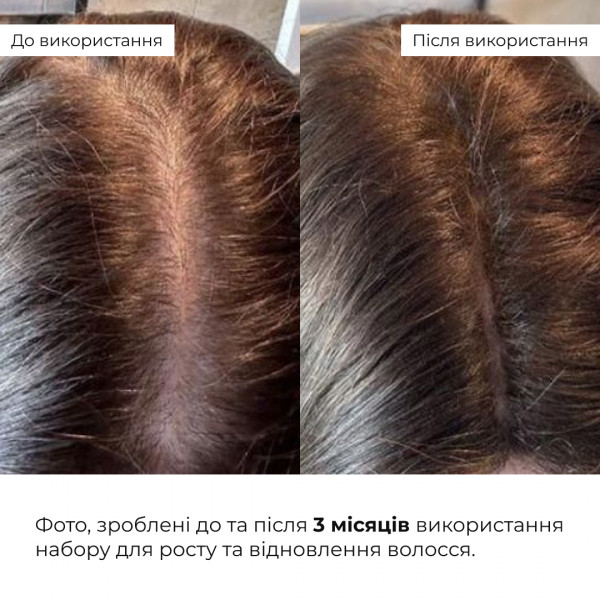 Шампунь для роста волос Hillary Hop Cones B5 Hair Growth Invigorating, 500 мл