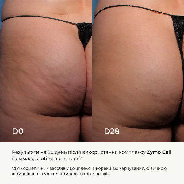 Антицеллюлитный энзимный гель Hillary Anti-cellulite Gel Zymo Cell, 200 мл