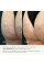 Набор с гоммажем, гелем и косметическими обертываниями для тела Hillary Body Care Set