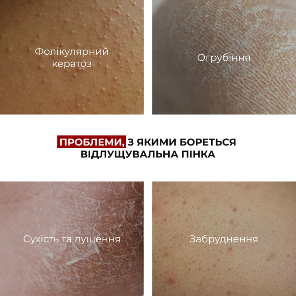 Комплекс мягкой эксфолиации тела и интимной гигиены Hillary Soft Body Exfoliation Intimate Hygiene Complex