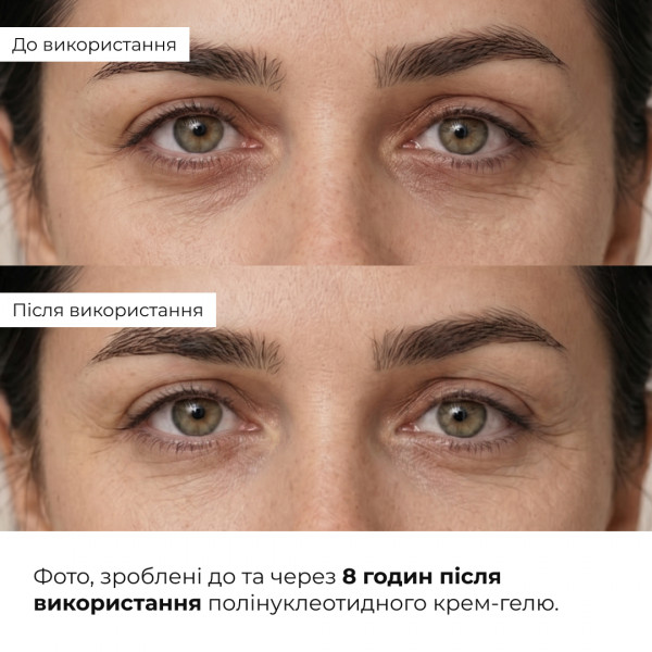 Набір для заспокоєння шкіри та зменшення ознак втоми навколо очей Hillary Soothing Skin & Tired Eye Care Set