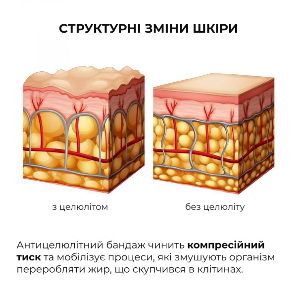 Скребок гуаша для массажа тела Антицеллюлитные средства Химения Anti-cellulite