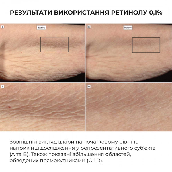 Комплекс глубокого ночного обновления кожи ReNuAge Retinol Collagen Night Ritual