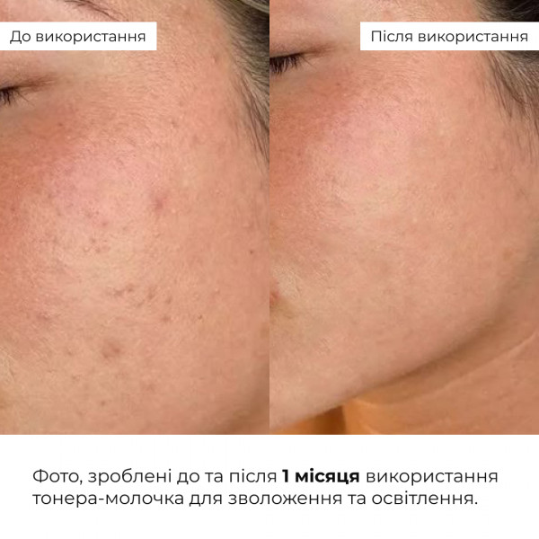 Набор с центеллой: гель, тонер-молочко и сыворотка Hillary Centella Face Care Set