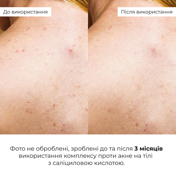 Набор из двух средств для ухода за кожей тела Hillary Body Duo