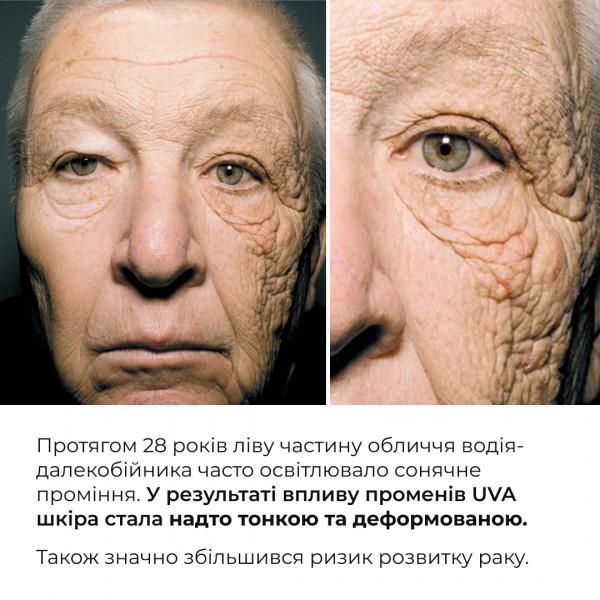 Комплекс солнцезащитных средств для волос, лица и тела Hillary Sun Protection Complex for Hair