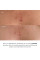 Комплекс для отшелушивания и коррекции сыпи на теле Hillary Exfoliation Body Acne Correction Complex