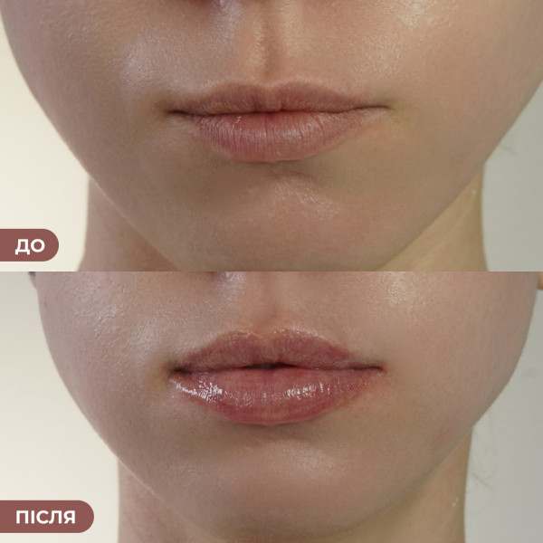 Набор блесков для интенсивного увлажнения и сияющих губ Hillary Deep Hydration Radiance Lip Trio
