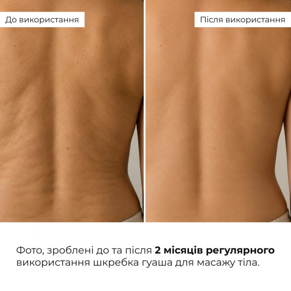 Массажный набор гуаша для тела