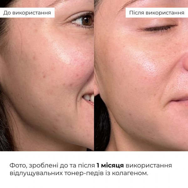 Отшелушивающие тонер-педы с коллагеном и пептидами Hillary Collagen Peptide Peeling Pads, 60 шт
