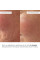 Комплекс пептидного омоложения и коррекции морщин Hillary Collagen Peptide Anti-Age Wrinkle Correction Set