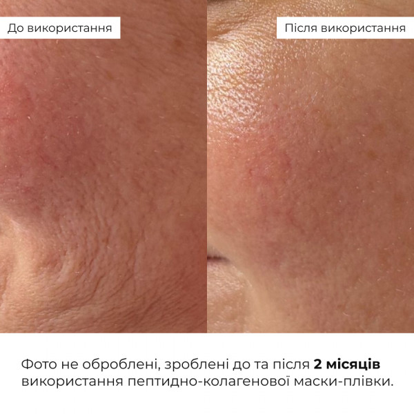 Комплекс пептидного омоложения и коррекции морщин Hillary Collagen Peptide Anti-Age Wrinkle Correction Set