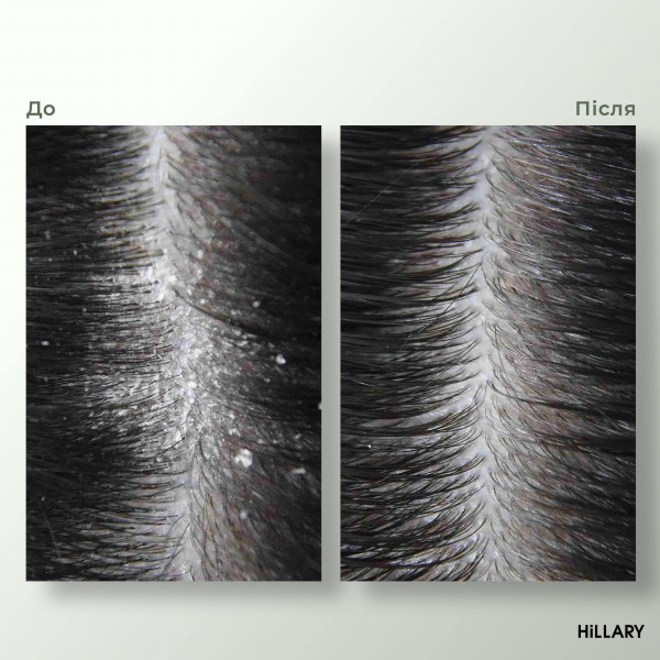 Комплекс HBS Обновление Hillary Hair Body Skin Renewal