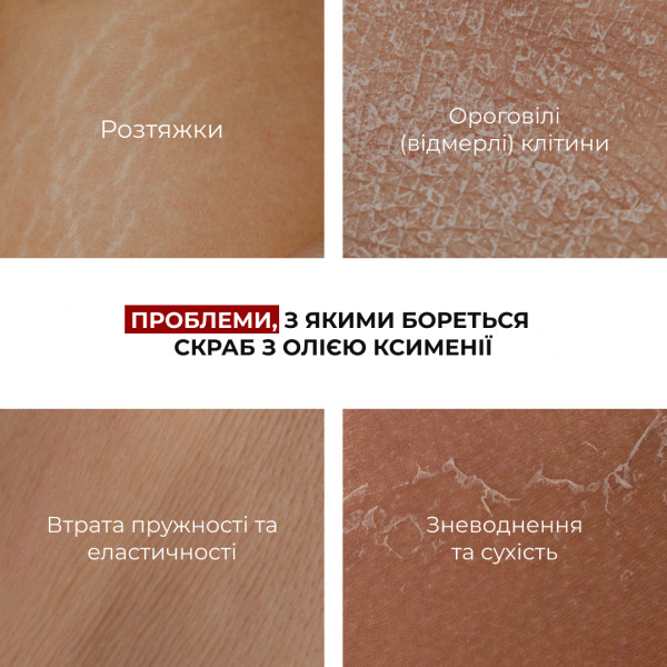 Cкраб с маслом ксимении для предупреждения появления растяжек Hillary Ximenia Radiance Body Scrub, 200 г