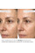 Набор для восстановления упругости и контуров кожи ReNuAge Exosome Collagen Contour Set