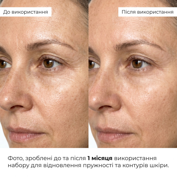 Набор для восстановления упругости и контуров кожи ReNuAge Exosome Collagen Contour Set