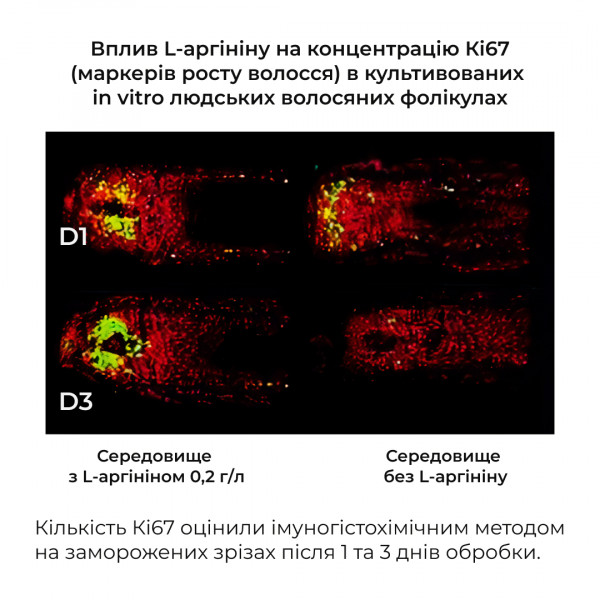 Высококонцентрированный комплекс для волос с экстрактом карликовой пальмы Hillary CONСENTRATE SERENOA, 50 мл
