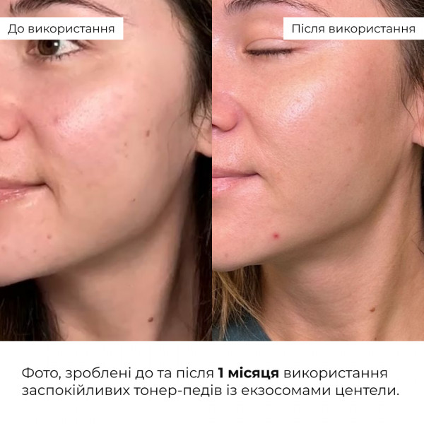 Успокаивающие тонер-педы с экзосомами центеллы Hillary Centella Exosome Soothing Pads, 60 шт