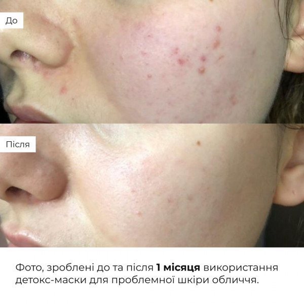 Глиняная маска для очищающего ухода за кожей лица Hillary Clay Mask, 90 мл
