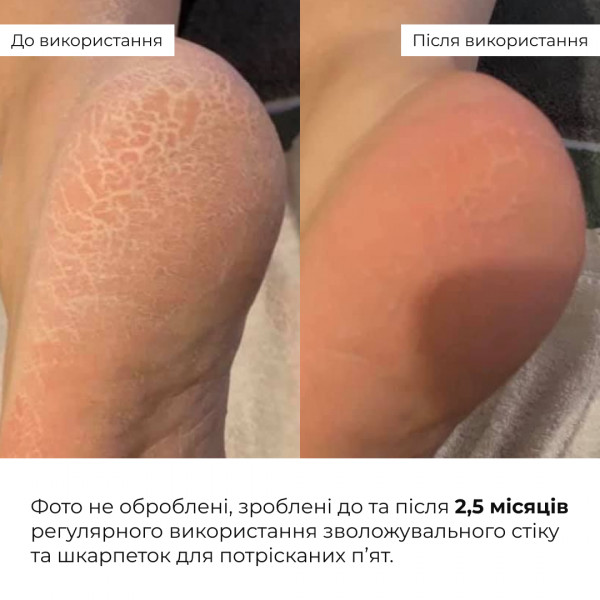 Набор для ухода за стопами Hillary HydraHeel: стик, носки и спрей-дезодорант