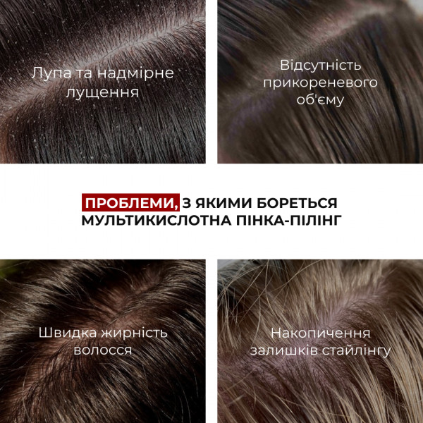 Набір для очищення шкіри голови та відновлення пошкодженого волосся HiLLARY