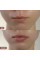Набор блесков для объема и увлажнения для губ Hillary Lip Volume Hydration Gloss Set