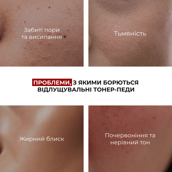 Комплекс антивікового догляду для оновлення та розгладження текстури шкіри HiLLARY