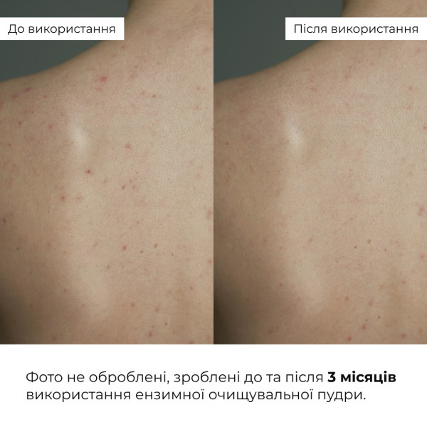 Энзимная очистительная пудра для жирной и комбинированной кожи HiLLARY Enzyme Balance Cleanser Powder, 40 г