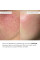 Набор с центеллой для сухой и нормальной кожи Hillary Perfect Centella Deep Hydration