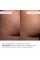 Курс антицеллюлитного ухода в домашних условиях с ниацинамидом Hillary Niacinamide Anti-Cellulite Home Care