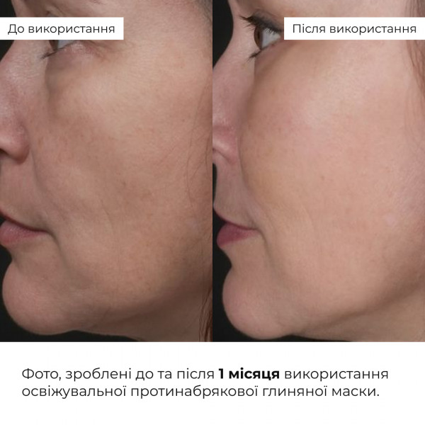 Освежающая противоотечная глиняная маска Hillary Revive Refresh Clay Mask, 90 мл