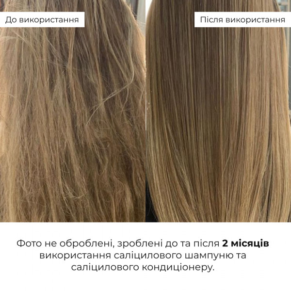 Кондиционер салициловый для восстановления волос Hillary Salicylic Hair Reset Conditioner, 400 мл