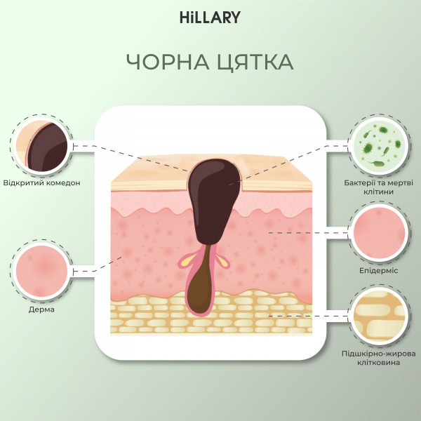 Набор для комплексного ухода за жирной и проблемной кожей Hillary Perfect 9