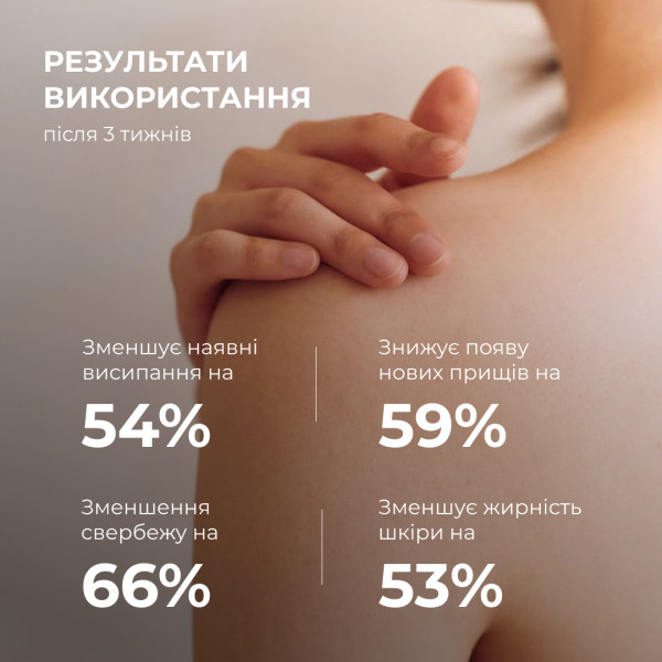 Очищающий гель для тела с салициловой кислотой Hillary Anti-Acne Salicylic Body Wash, 200 мл