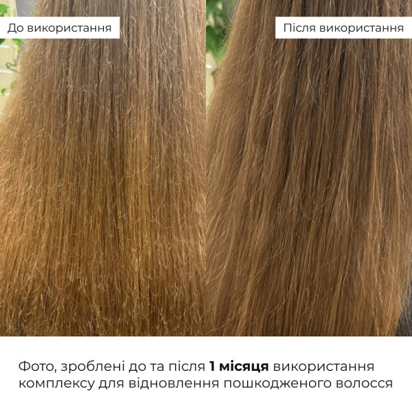 Комплекс для жирної шкіри голови та відновлення пошкодженого волосся HiLLARY