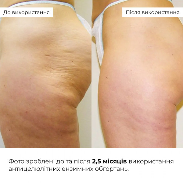 Комплекс антицеллюлитных энзимных обертываний Hillary Anti-cellulite Bandage Zymo Cell (10 уп.)