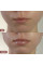 Набор против трещин и для увлажнения губ Hillary Lip Repair Hydration Set